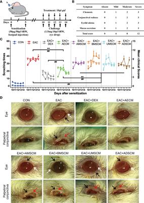 Conditioned Medium of Human Amniotic Epithelial Cells Alleviates Experimental Allergic Conjunctivitis Mainly by IL-1ra and IL-10